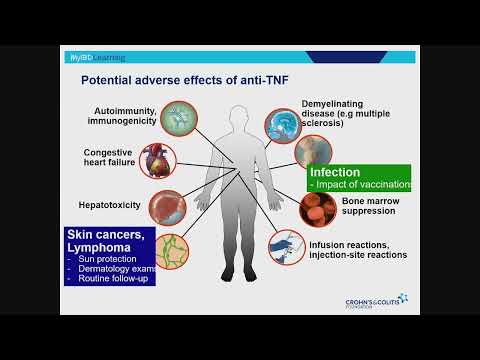 IBD Therapy: Past, Present, Future