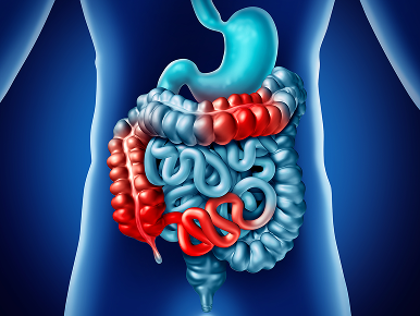 An illustration of the stomach, large intestine, and small intestine, with red areas in the intestine to indicate inflammation and flares.
