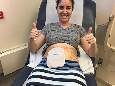  Young woman with Ostomy sitting at a care center smiling and give two thumbs up.