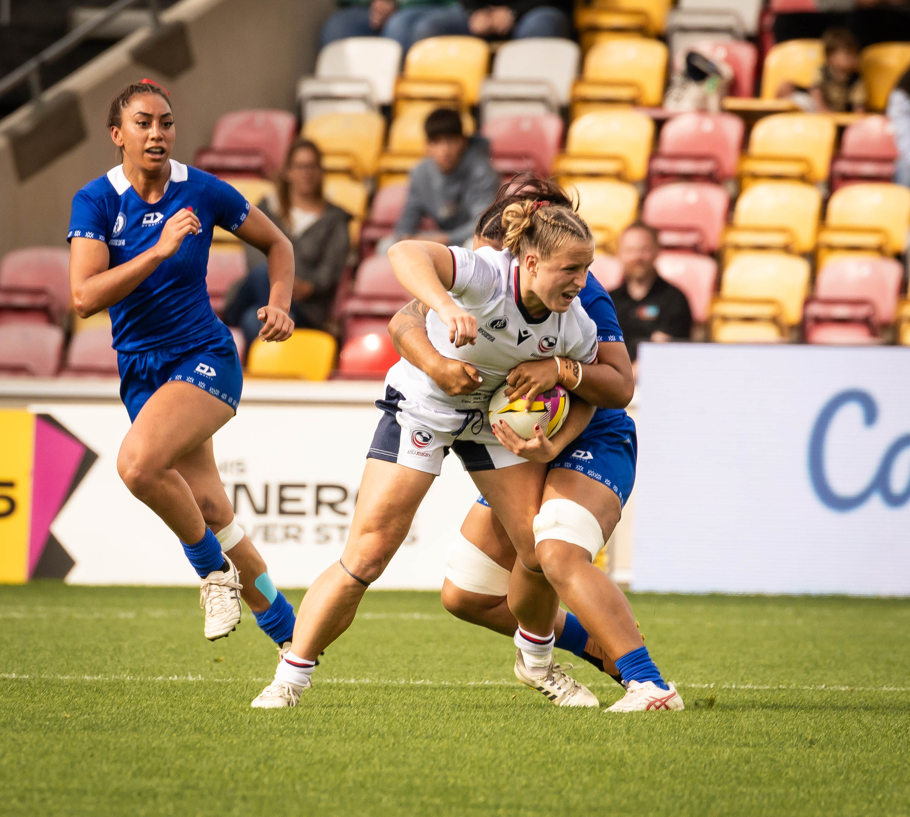 Cass Bargell, Ostomate and professional rugby player with ulcerative colitis