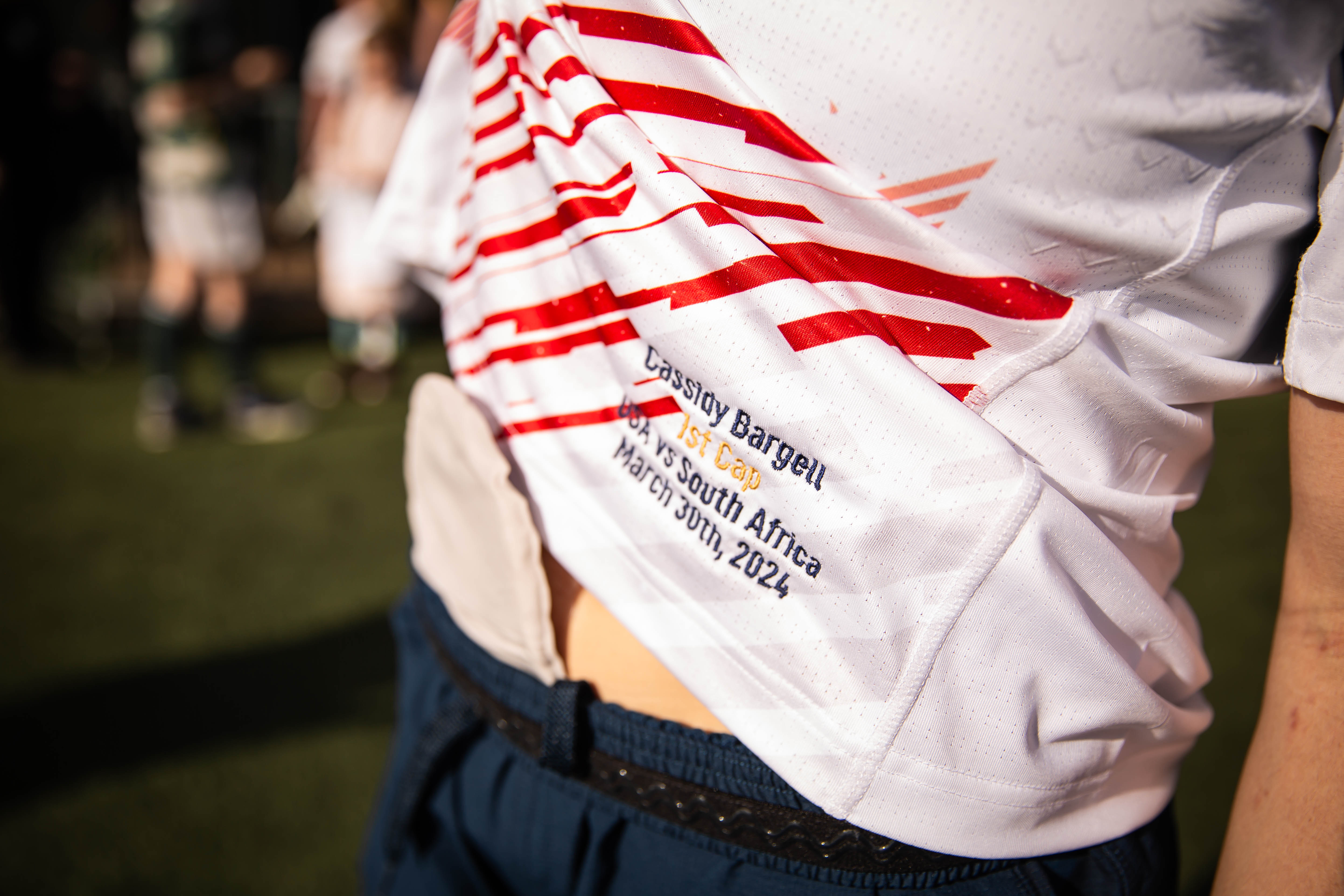 Cass Bargell, Ostomate and professional rugby player with ulcerative colitis