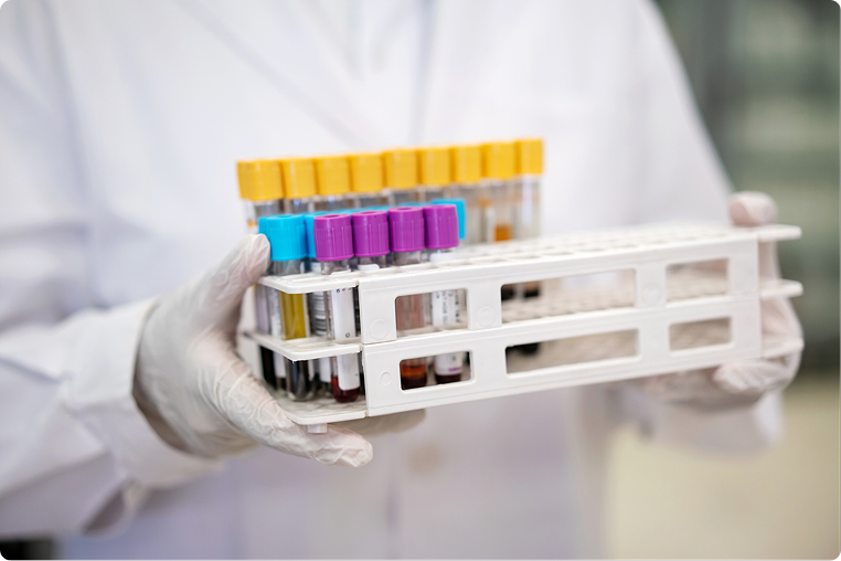 Medical lab technician holding a case with blood samples in test tubes.