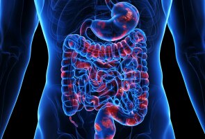 IBD Illustration