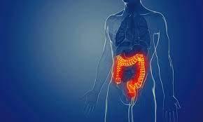 IBD