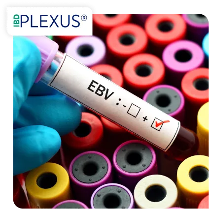 Plexus