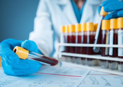 Scientist handling blood samples